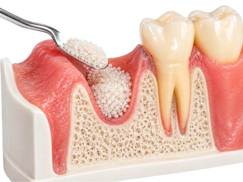 Confident natural smile after dental grafting