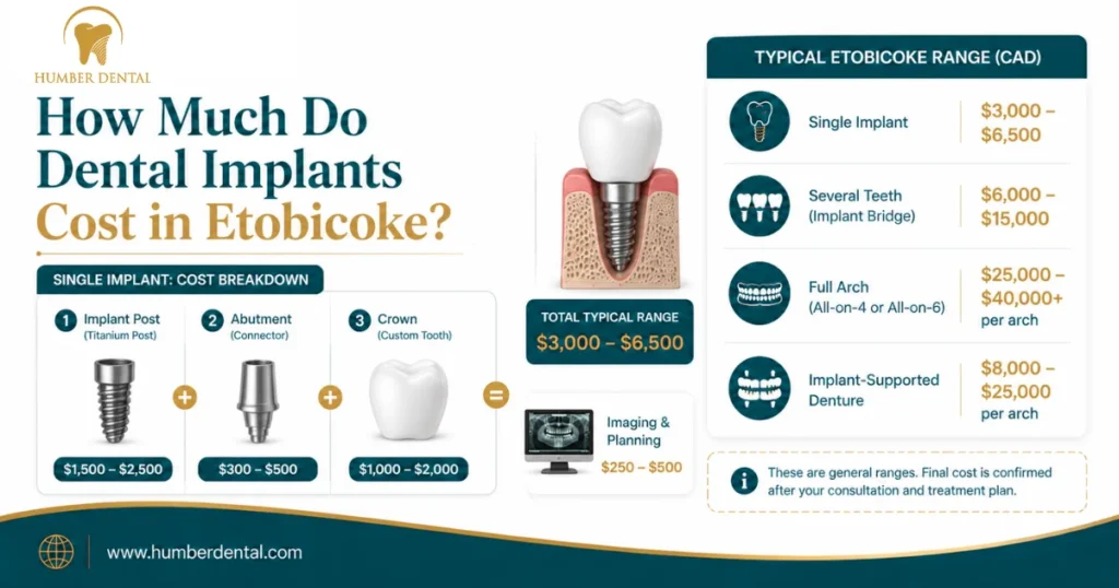 How Much Do Dental Implants Cost in Etobicoke?