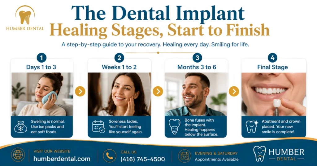 The Dental Implant Healing Stages, Start to Finish